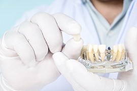 a gloved hand holding a model of dental implants